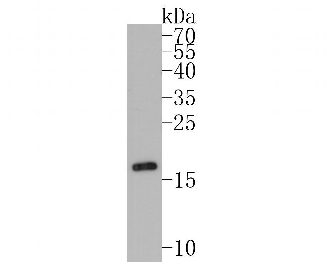 Cardiac Troponin C Antibody in Western Blot (WB)