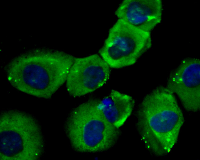 TGM2 Antibody in Immunocytochemistry (ICC/IF)