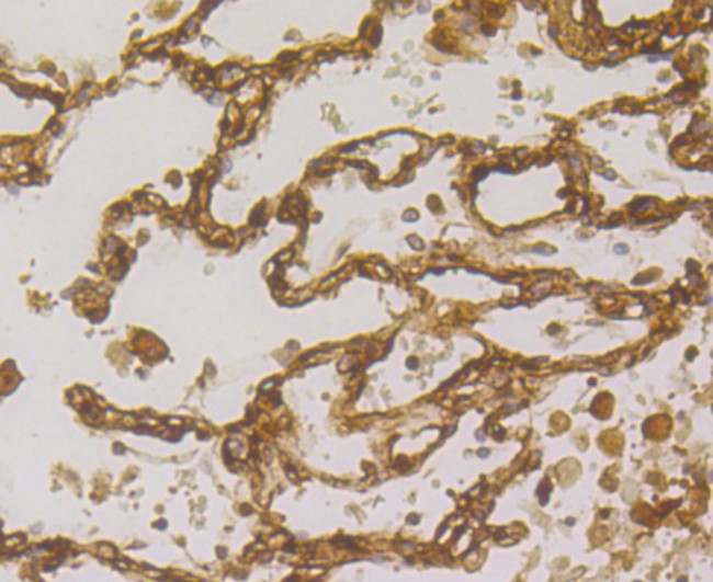 TGM2 Antibody in Immunohistochemistry (Paraffin) (IHC (P))