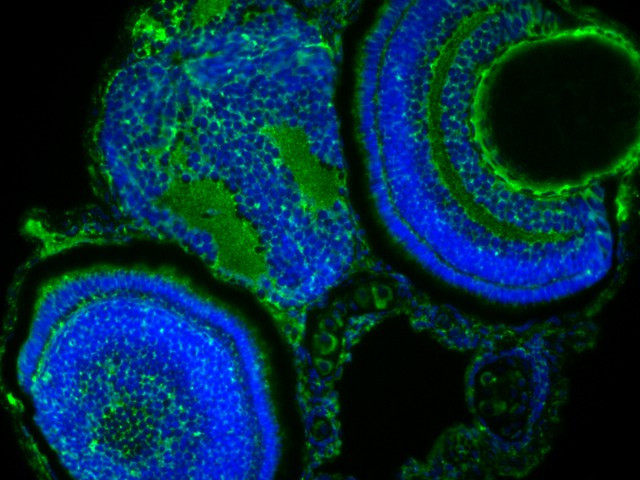 SARS2 Antibody in Immunohistochemistry (PFA fixed) (IHC (PFA))