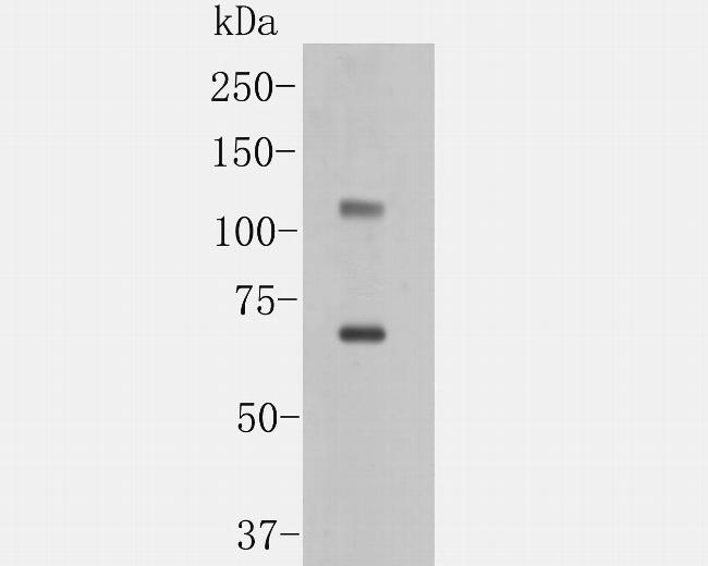 ACE2 Antibody in Western Blot (WB)