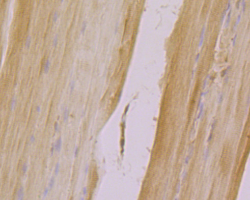 CLIC4 Antibody in Immunohistochemistry (Paraffin) (IHC (P))