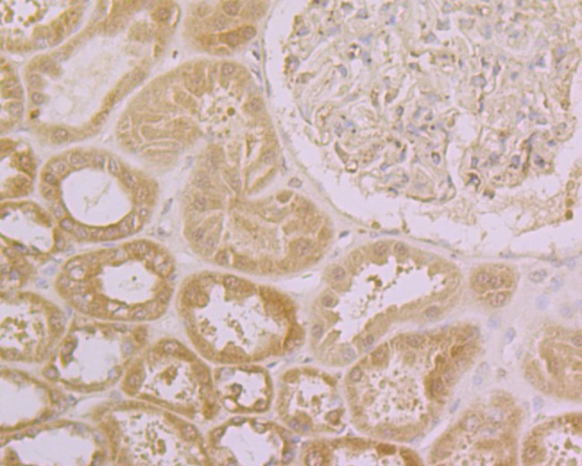 CLIC4 Antibody in Immunohistochemistry (Paraffin) (IHC (P))