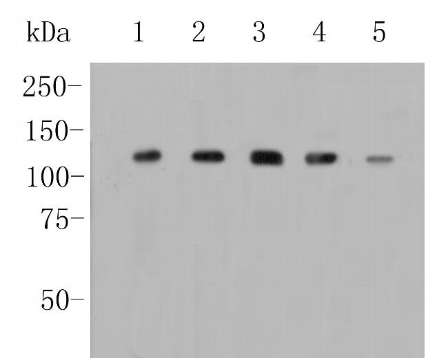 Drebrin Antibody in Western Blot (WB)