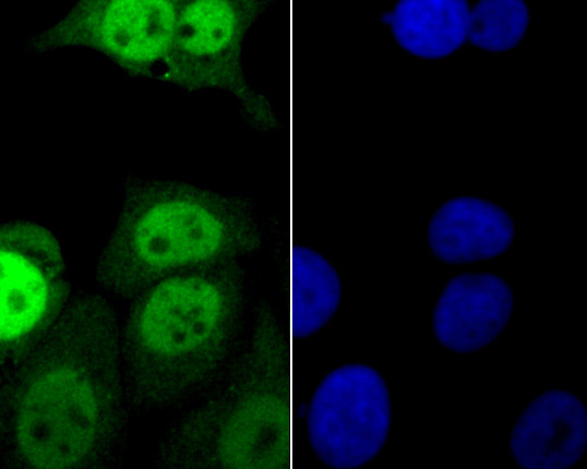 FEN1 Antibody in Immunocytochemistry (ICC/IF)