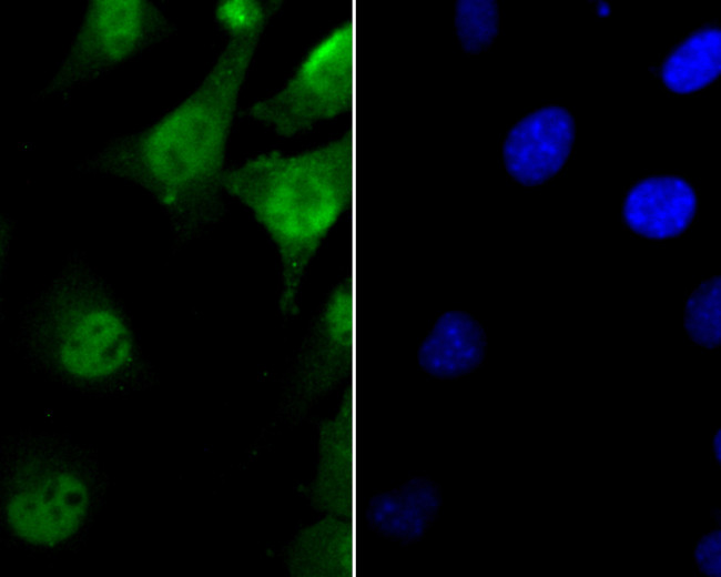 FEN1 Antibody in Immunocytochemistry (ICC/IF)