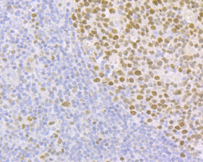 FEN1 Antibody in Immunohistochemistry (Paraffin) (IHC (P))