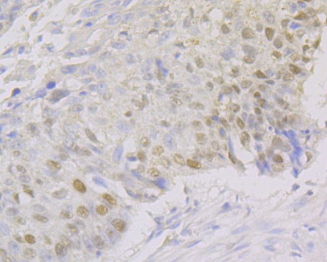 FEN1 Antibody in Immunohistochemistry (Paraffin) (IHC (P))