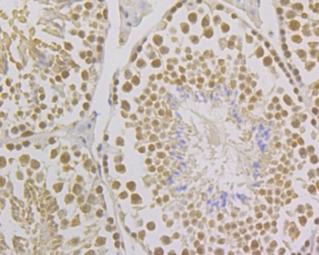 FEN1 Antibody in Immunohistochemistry (Paraffin) (IHC (P))