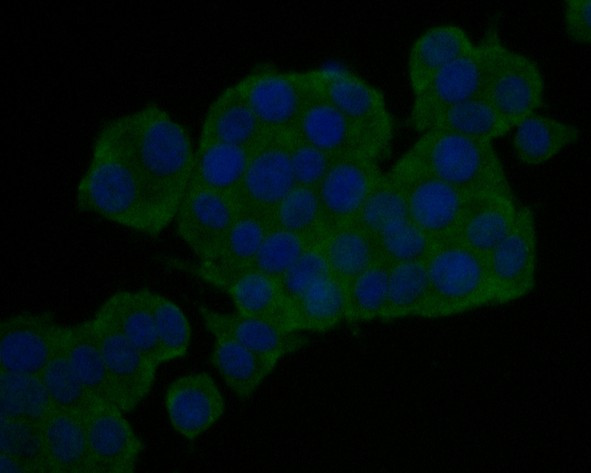 KIDINS220 Antibody in Immunocytochemistry (ICC/IF)