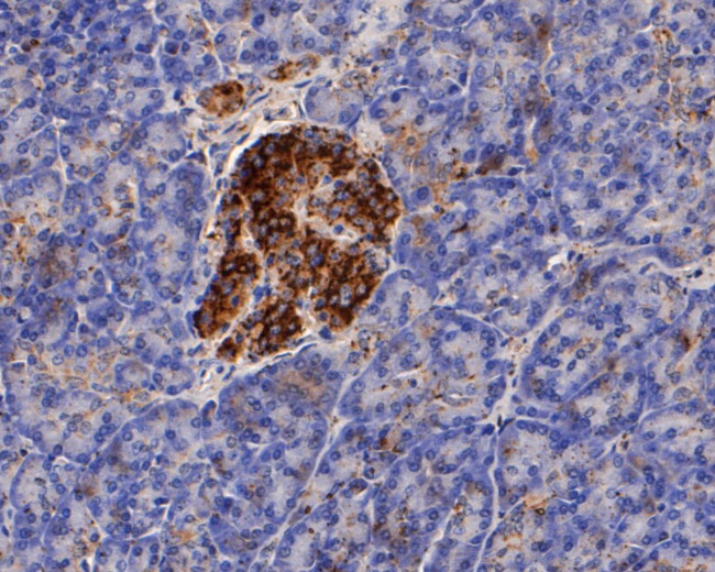 KIDINS220 Antibody in Immunohistochemistry (Paraffin) (IHC (P))