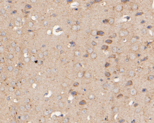 KIDINS220 Antibody in Immunohistochemistry (Paraffin) (IHC (P))