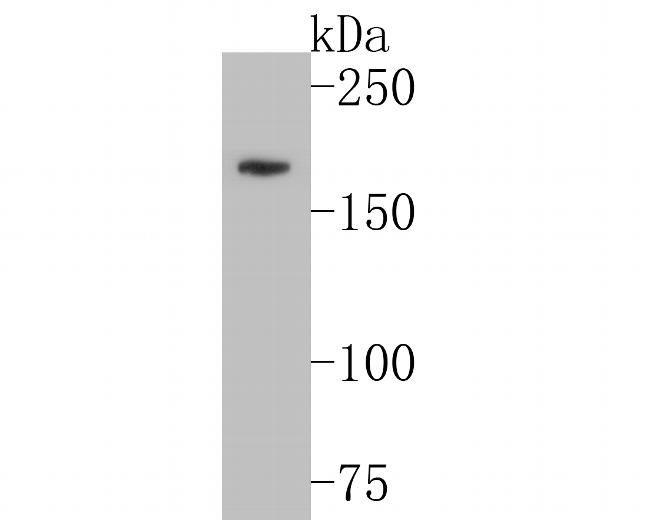 KIDINS220 Antibody in Western Blot (WB)