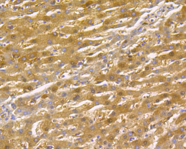 Thymidine Phosphorylase Antibody in Immunohistochemistry (Paraffin) (IHC (P))