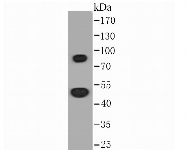 Thymidine Phosphorylase Antibody in Western Blot (WB)