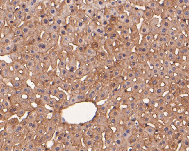 Rab11 FIB3 Antibody in Immunohistochemistry (Paraffin) (IHC (P))