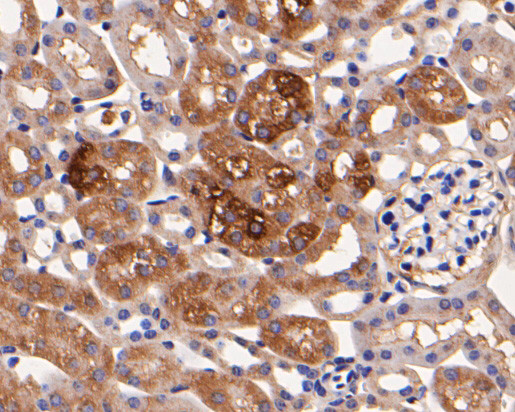 Rab11 FIB3 Antibody in Immunohistochemistry (Paraffin) (IHC (P))