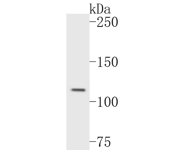 Rab11 FIB3 Antibody in Western Blot (WB)