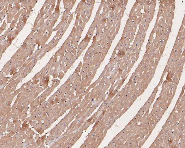 TRPM4 Antibody in Immunohistochemistry (Paraffin) (IHC (P))