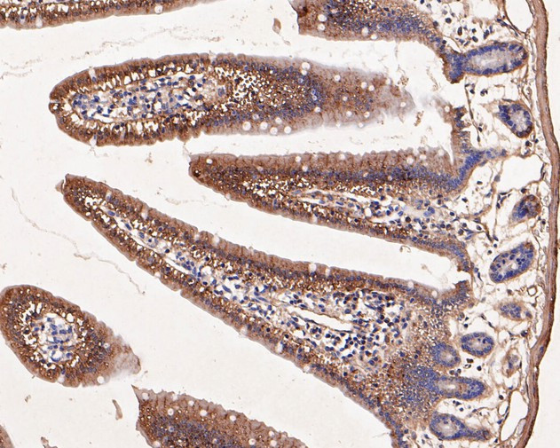 TRPM4 Antibody in Immunohistochemistry (Paraffin) (IHC (P))