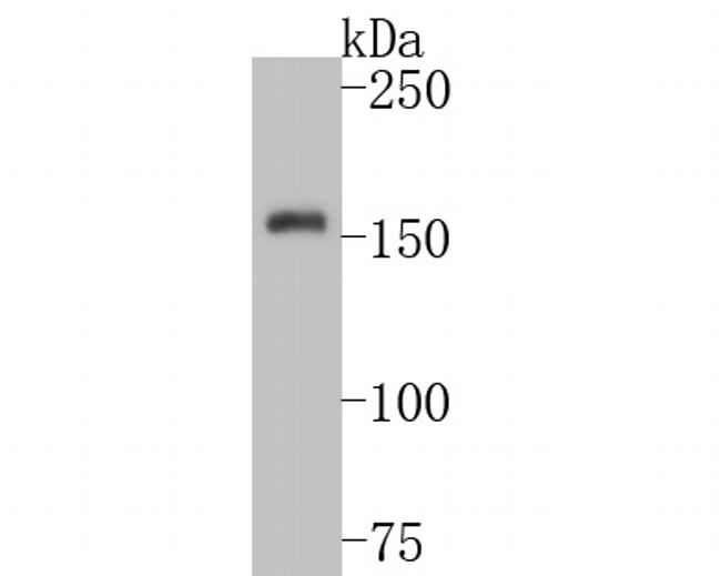 TRPM4 Antibody in Western Blot (WB)