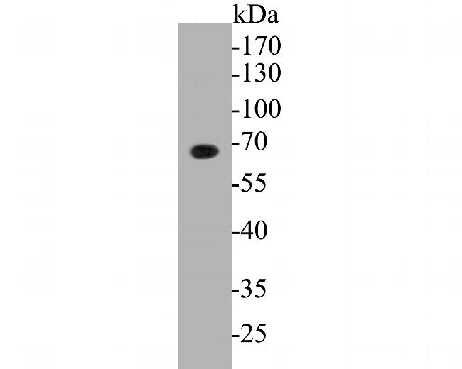 GABRA5 Antibody in Western Blot (WB)