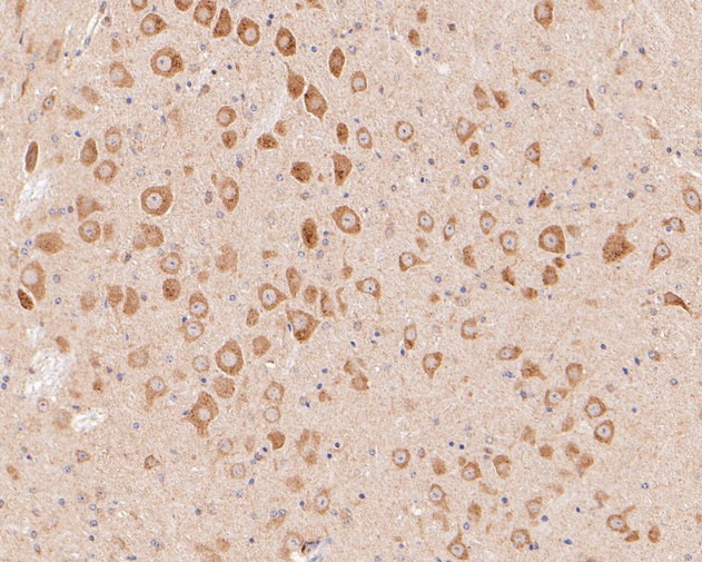 P2X3 Antibody in Immunohistochemistry (Paraffin) (IHC (P))