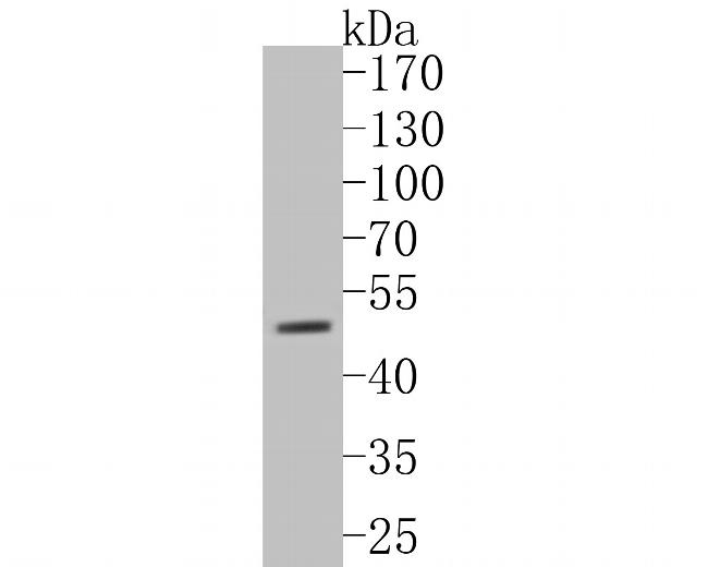 P2X3 Antibody in Western Blot (WB)