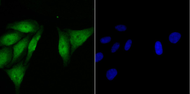 BIN1 Antibody in Immunocytochemistry (ICC/IF)