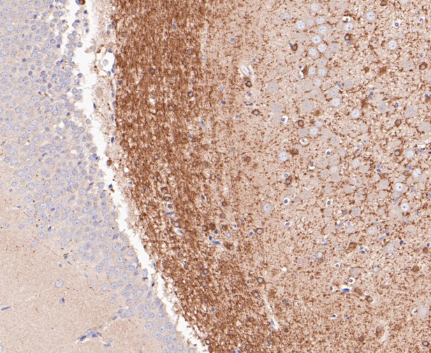 BIN1 Antibody in Immunohistochemistry (Paraffin) (IHC (P))