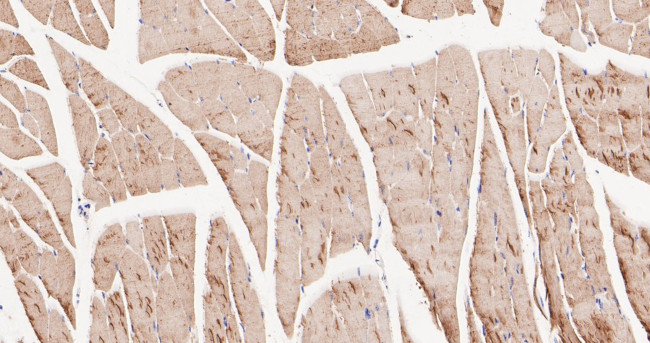 BIN1 Antibody in Immunohistochemistry (Paraffin) (IHC (P))