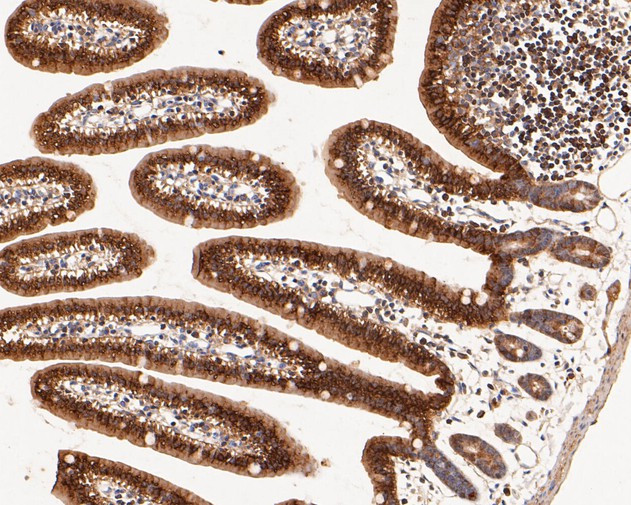 Aldolase B Antibody in Immunohistochemistry (Paraffin) (IHC (P))