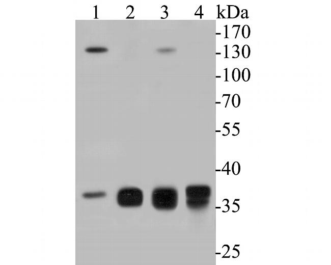 Aldolase B Antibody in Western Blot (WB)