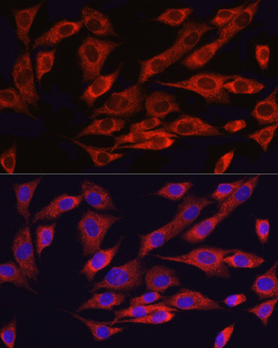 ATF6 Antibody in Immunocytochemistry (ICC/IF)