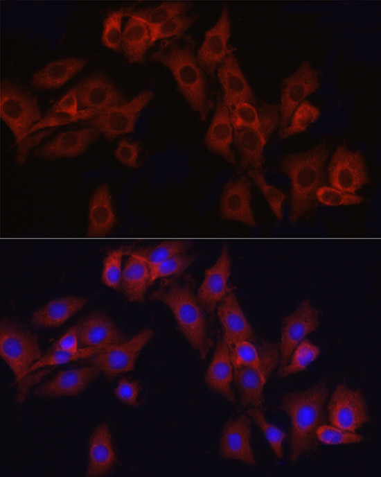 ATF6 Antibody in Immunocytochemistry (ICC/IF)