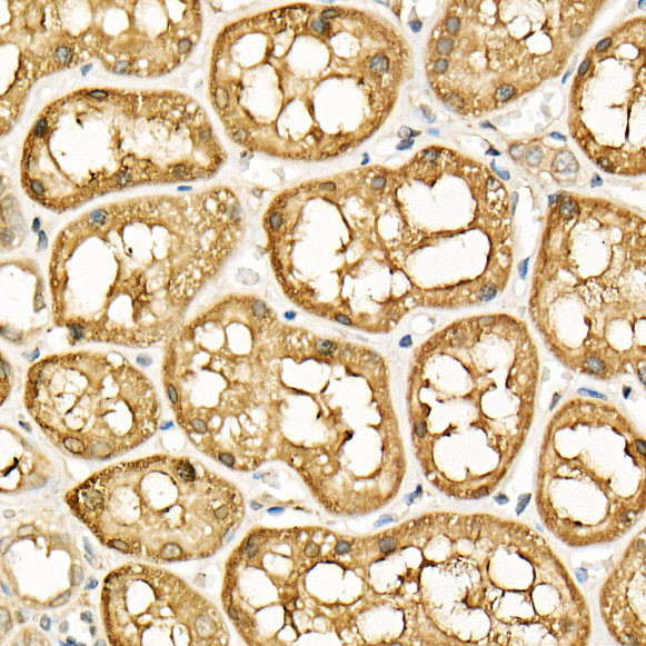 ATF6 Antibody in Immunohistochemistry (Paraffin) (IHC (P))