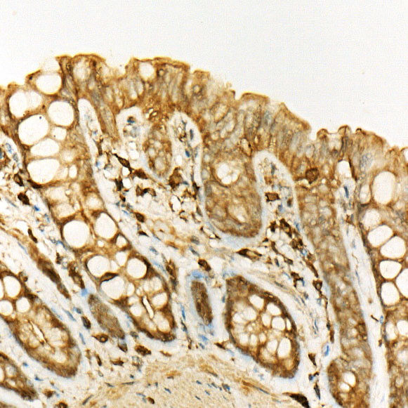 ATF6 Antibody in Immunohistochemistry (Paraffin) (IHC (P))