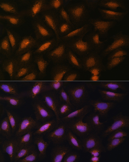 FGF2 Antibody in Immunocytochemistry (ICC/IF)