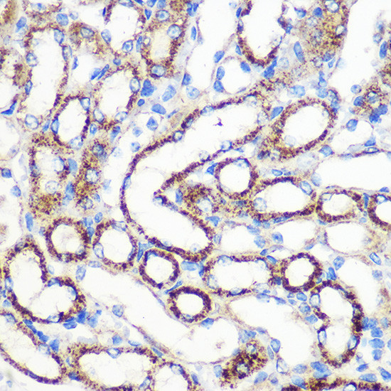 FGF2 Antibody in Immunohistochemistry (Paraffin) (IHC (P))