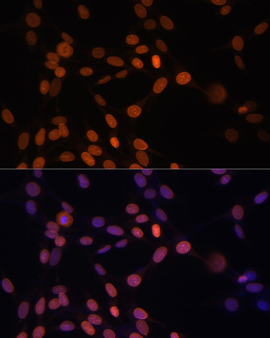 Lamin A/C Antibody in Immunocytochemistry (ICC/IF)