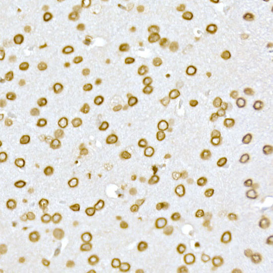 Lamin A/C Antibody in Immunohistochemistry (Paraffin) (IHC (P))