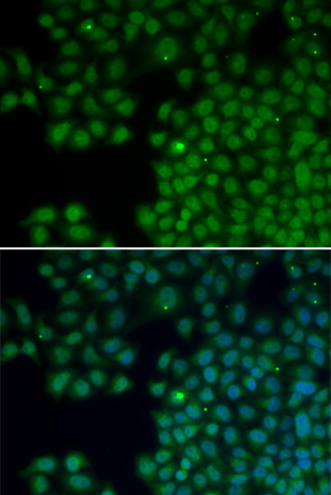 NUDT6 Antibody in Immunocytochemistry (ICC/IF)