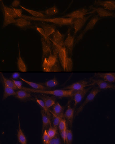 Caspase 9 Antibody in Immunocytochemistry (ICC/IF)