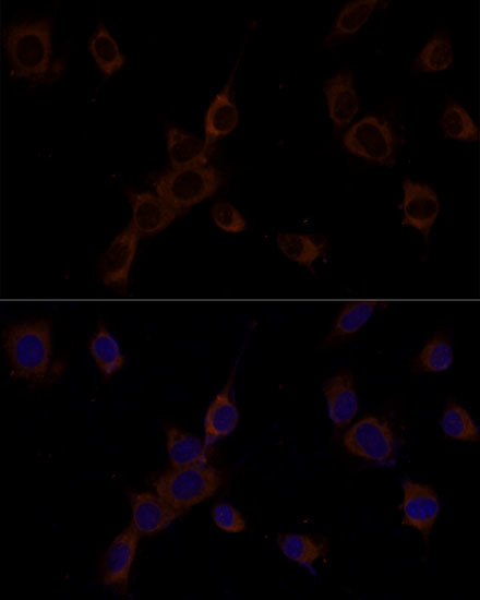 Caspase 9 Antibody in Immunocytochemistry (ICC/IF)