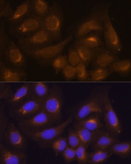 Caspase 9 Antibody in Immunocytochemistry (ICC/IF)