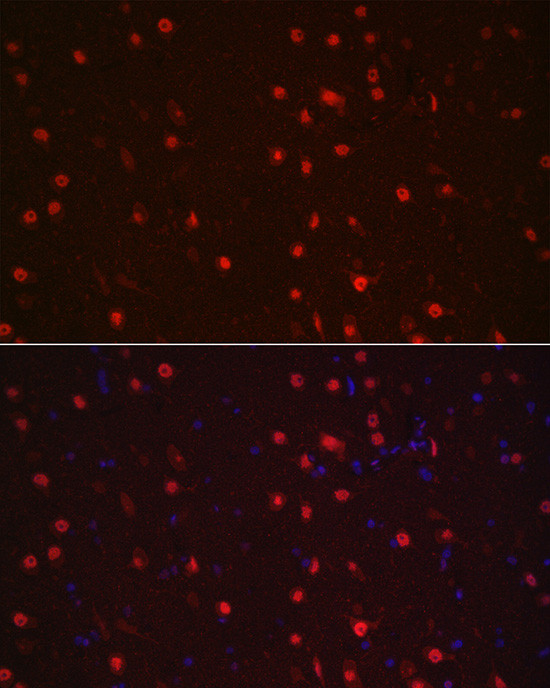 NeuN Antibody in Immunocytochemistry (ICC/IF)