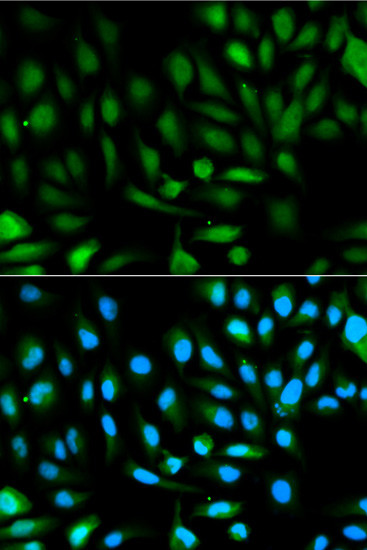 DJ-1 Antibody in Immunocytochemistry (ICC/IF)