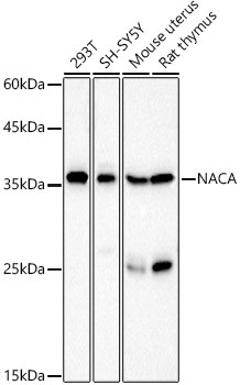 NACA Antibody in Western Blot (WB)