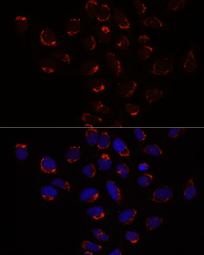 SLC25A1 Antibody in Immunocytochemistry (ICC/IF)