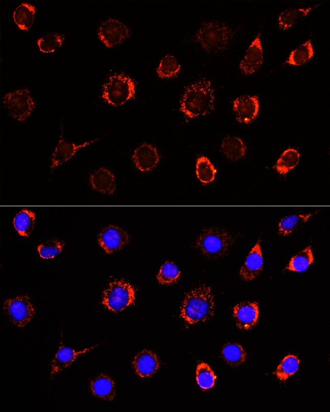 SLC25A1 Antibody in Immunocytochemistry (ICC/IF)